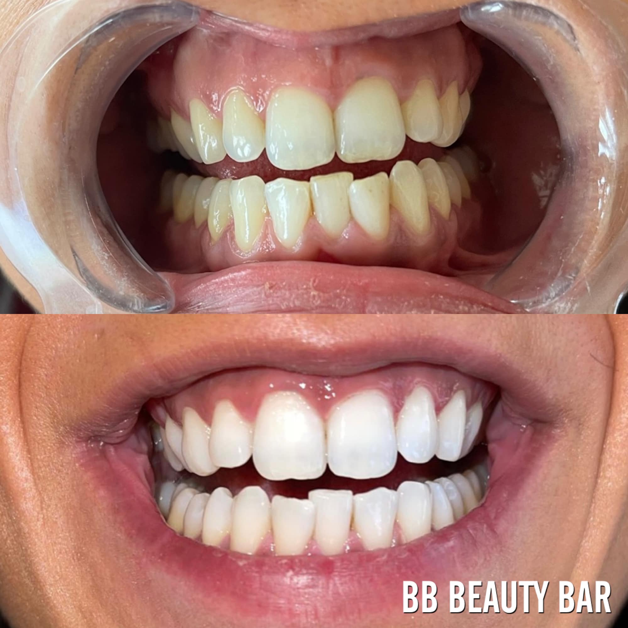 BB Beauty Bar